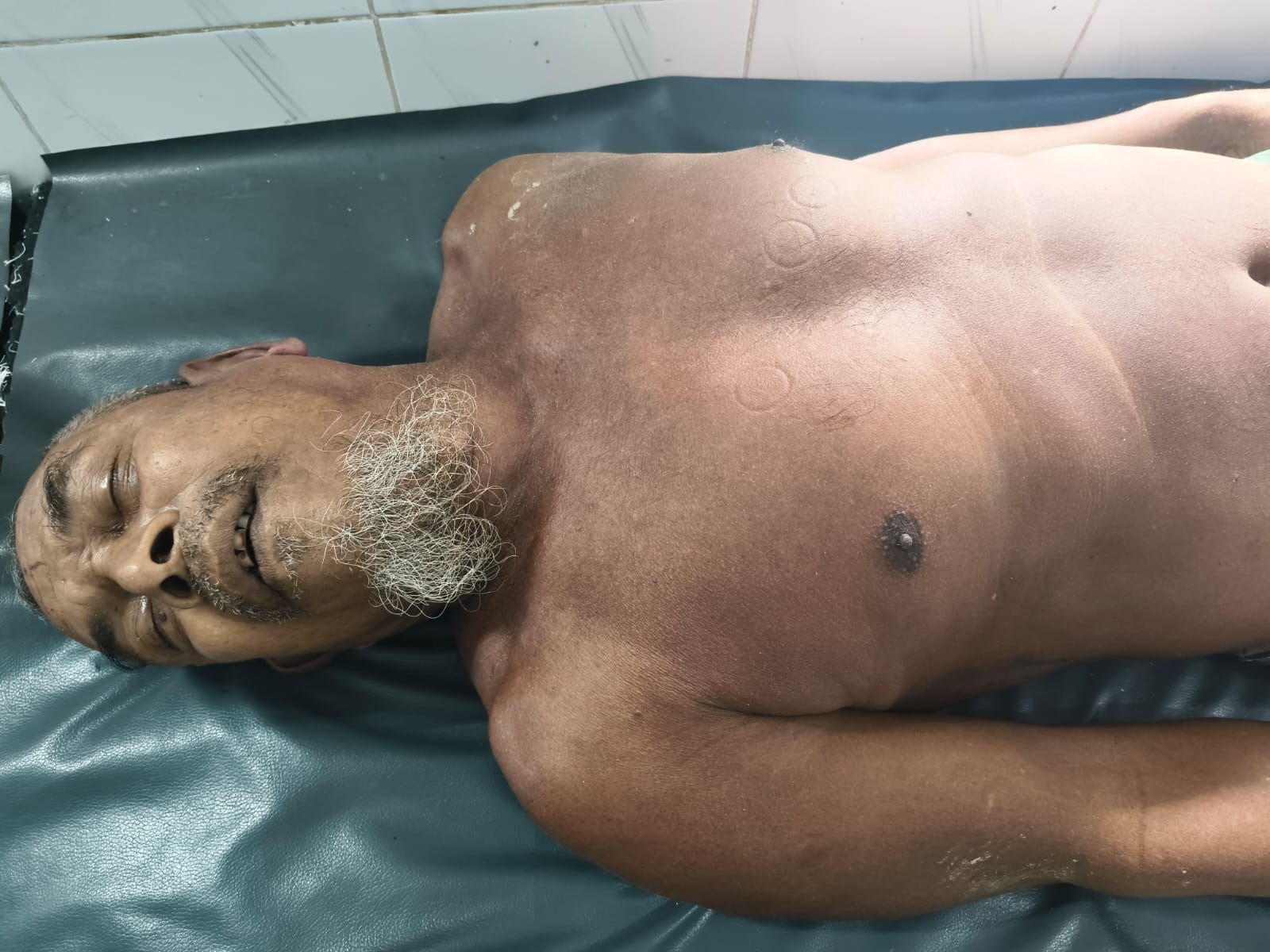 মা‌টিরাঙ্গায় বিদ‌্যুৎস্পৃষ্ঠ হয়ে নিহত ১,আহত ২